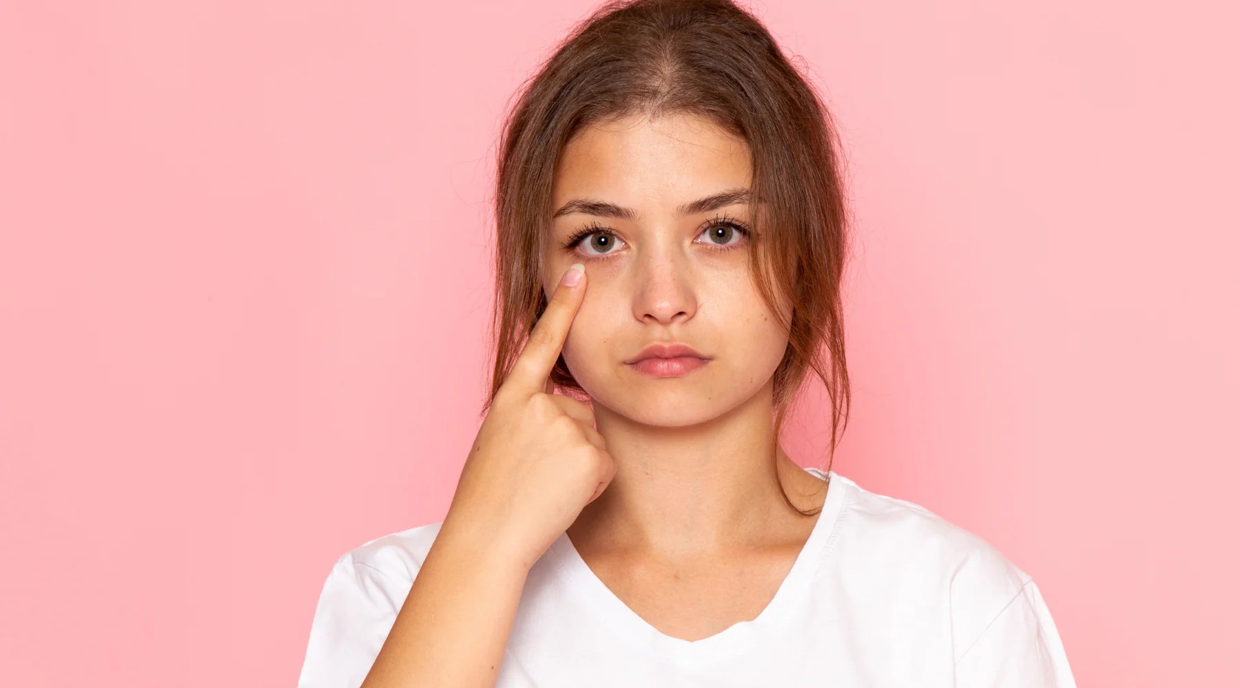 Getting Rid of Eye Bags Causes and Treatment V 10 Plus