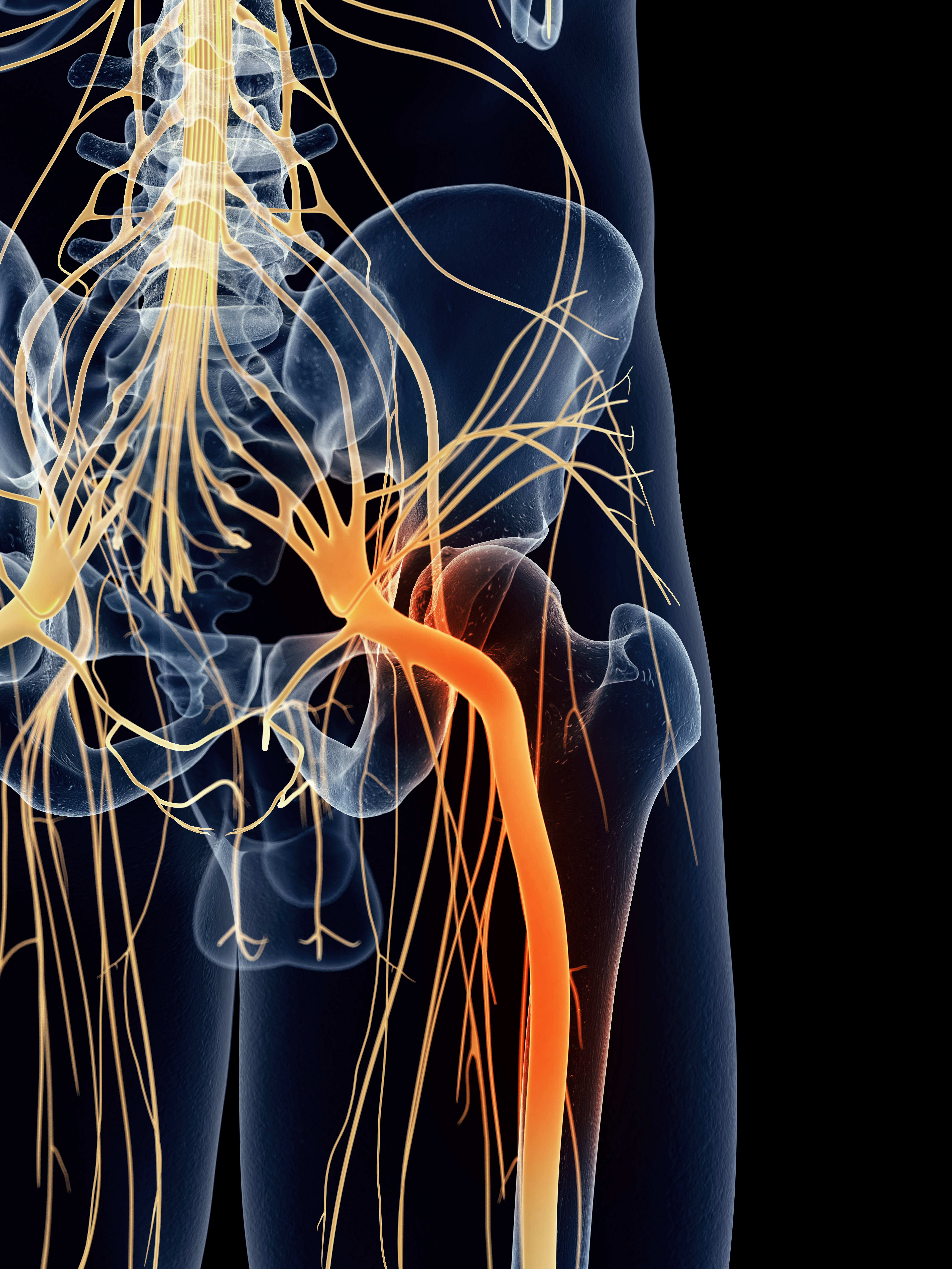 Avoid Sciatica Injuries With Chiropractic Treatment Depew, New York