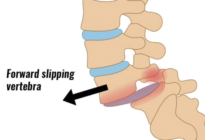 Home Long Island, NY Chiropractor Long Island Spine Care Affiliates