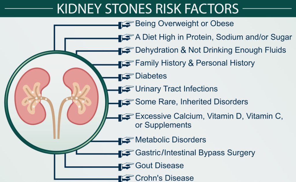 Do You Qualify For a Kidney Stones VA Rating? (Ultimate Guide)