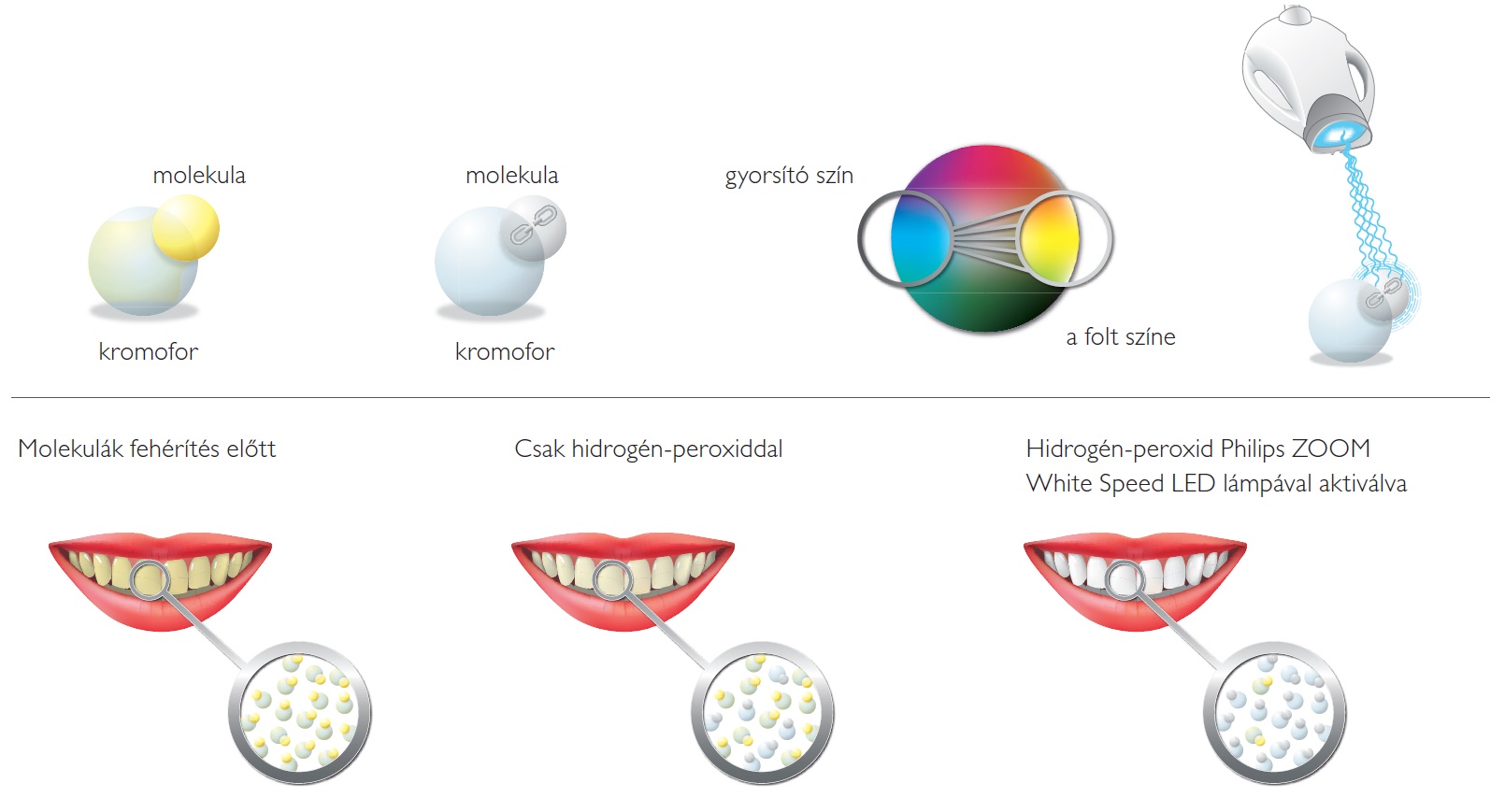 Philips ZOOM rendszer