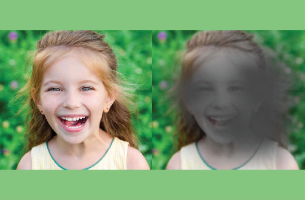 What is agerelated macular degeneration Value Your Eyes
