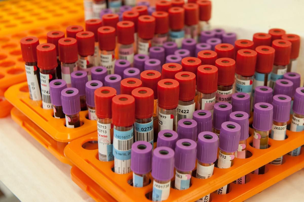 Kyla Lee in the Toronto Star Why are Canadian police using expired blood collection equipment