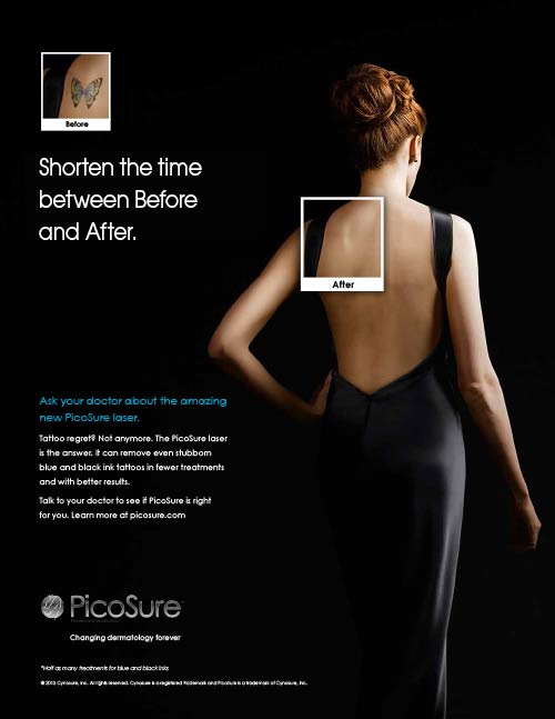 Vanessa Levin Writes » Cynosure / PicoSureTattoo RemovalPrint