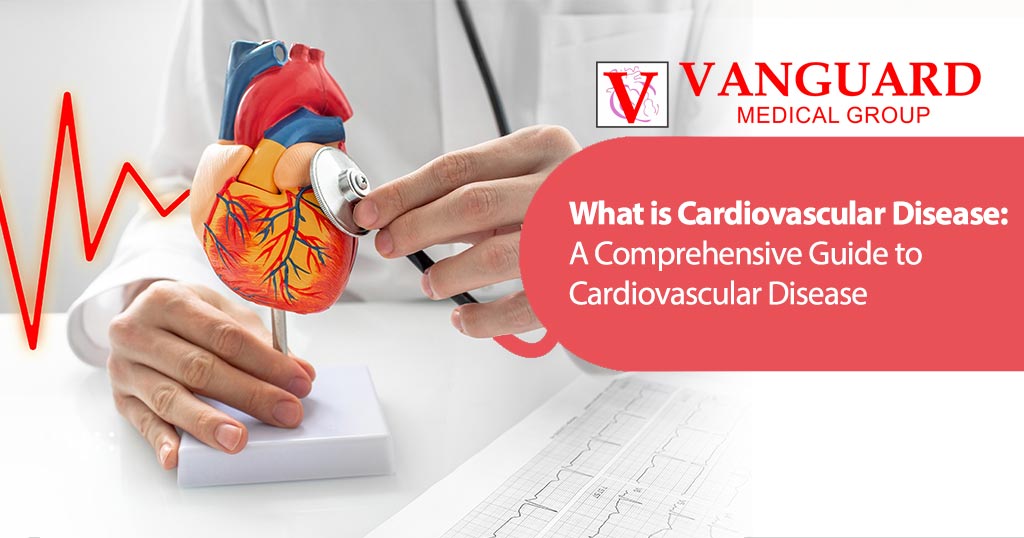 What is Cardiovascular Disease Symptoms, Causes & Treatments