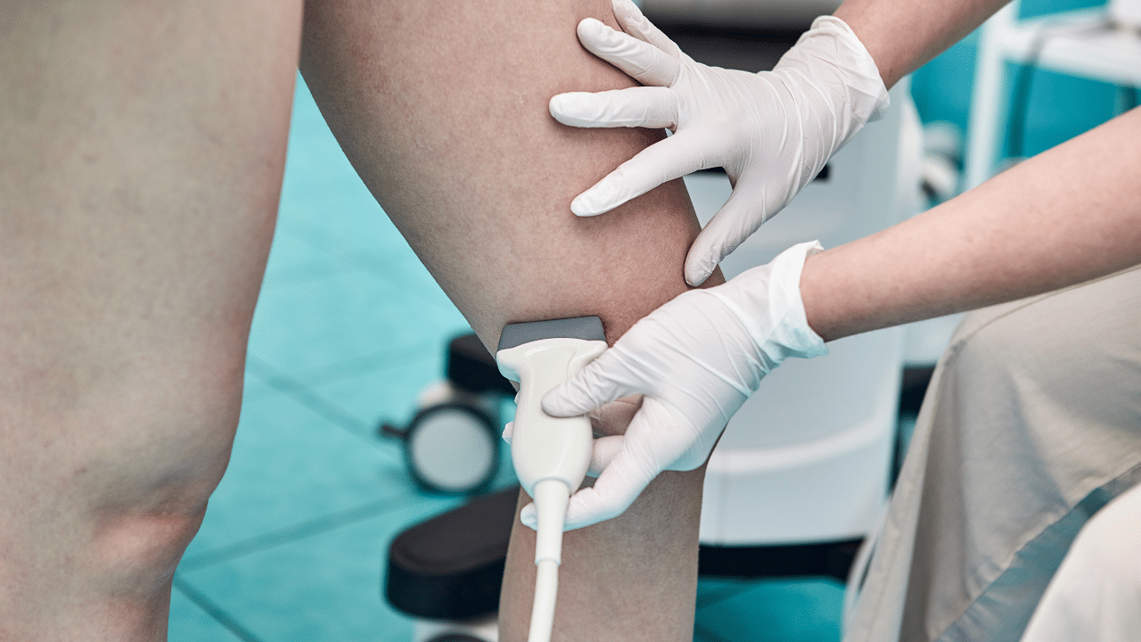 What Kind of Doctor Treats Vein Disease? Vanishing Veins Hartford, CT