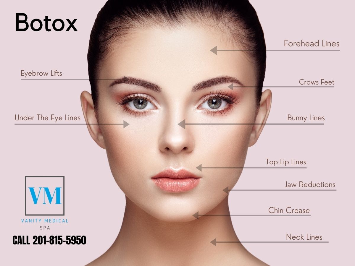 Botox Treatment in Teaneck, NJ. Call Vanity Medical Spa Now