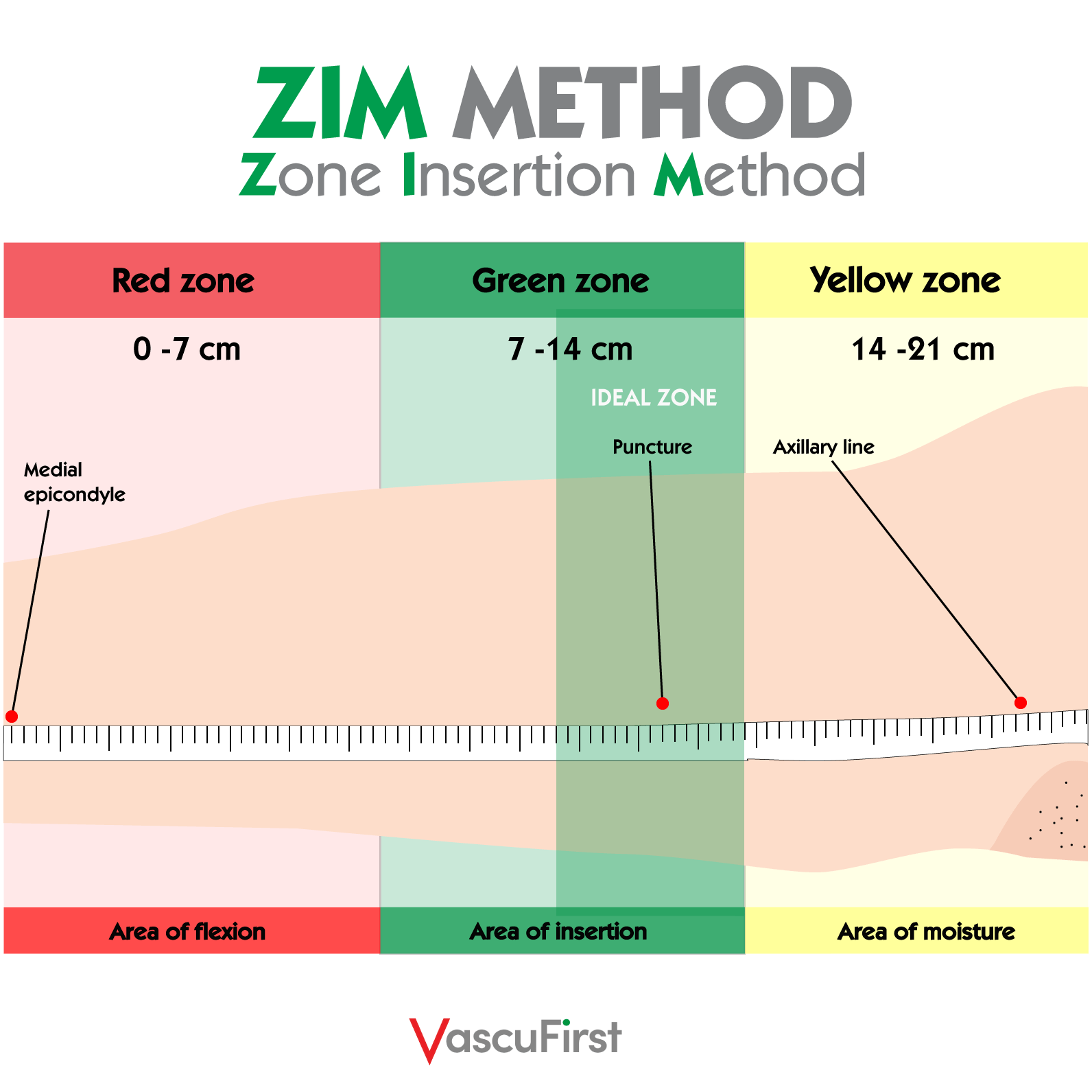 The use of the ZIM Method and tunnelling in PICC placement VascuFirst