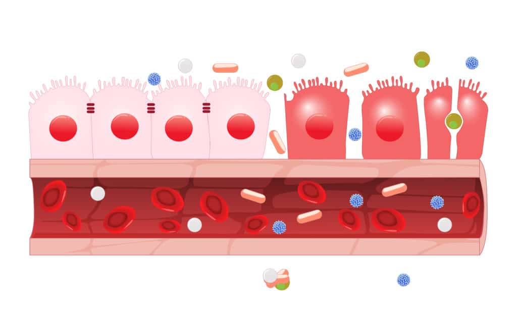 Leaky Gut o que é, sintomas, causas e como evitar. Sua saúde depende