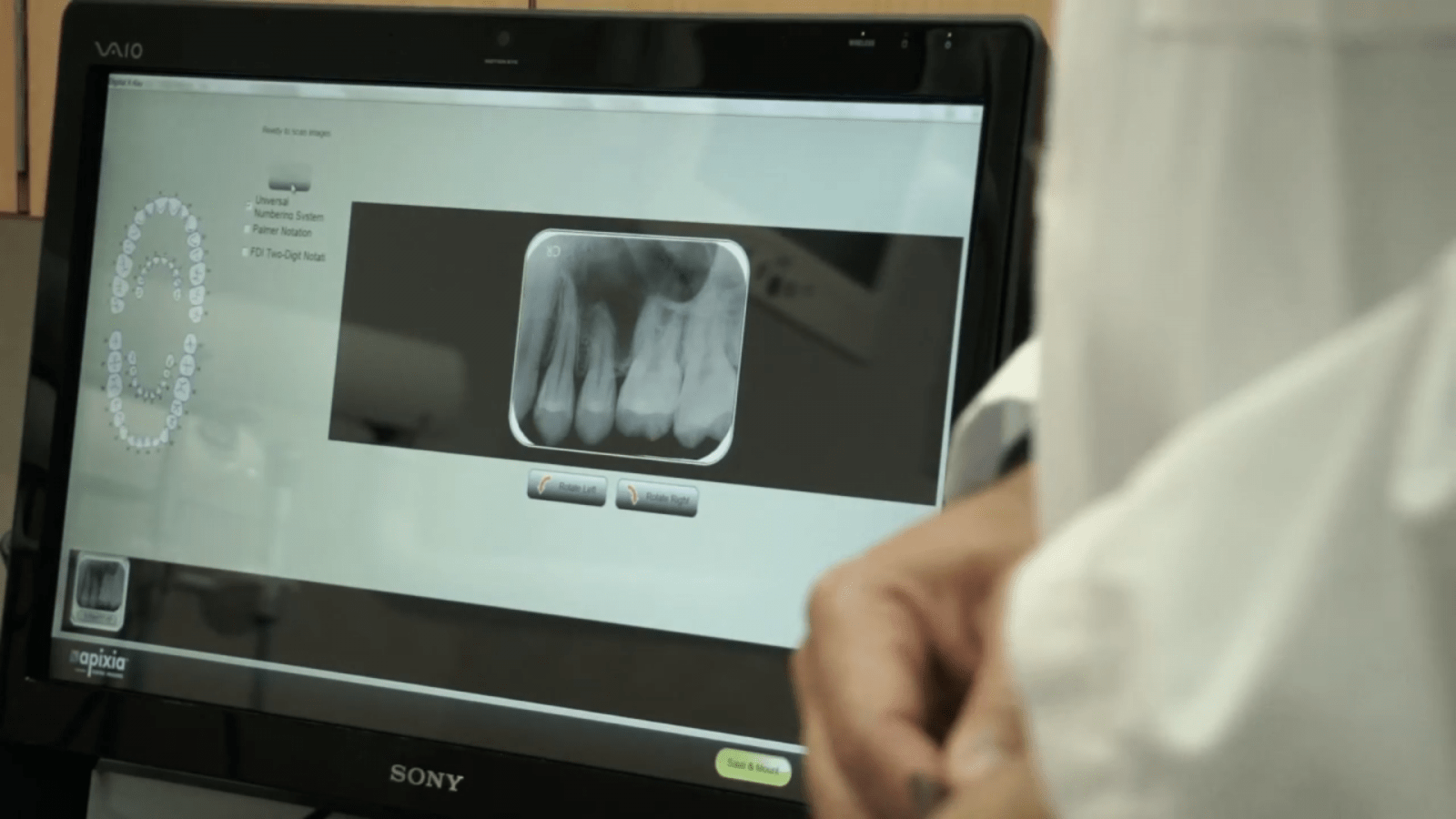 Apixia Digirex Dental Phosphor Plate (PSP) Digital XRay Scanner