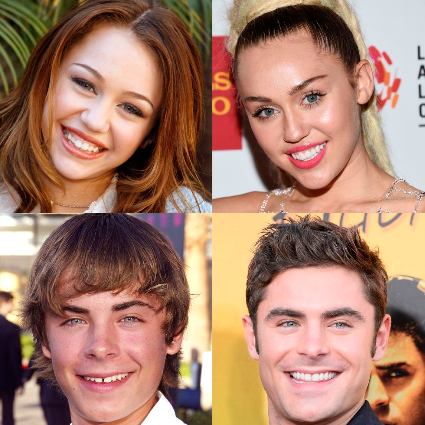 Bhad Bhabie New Smile Dental Veneers transformation Dental Veneers