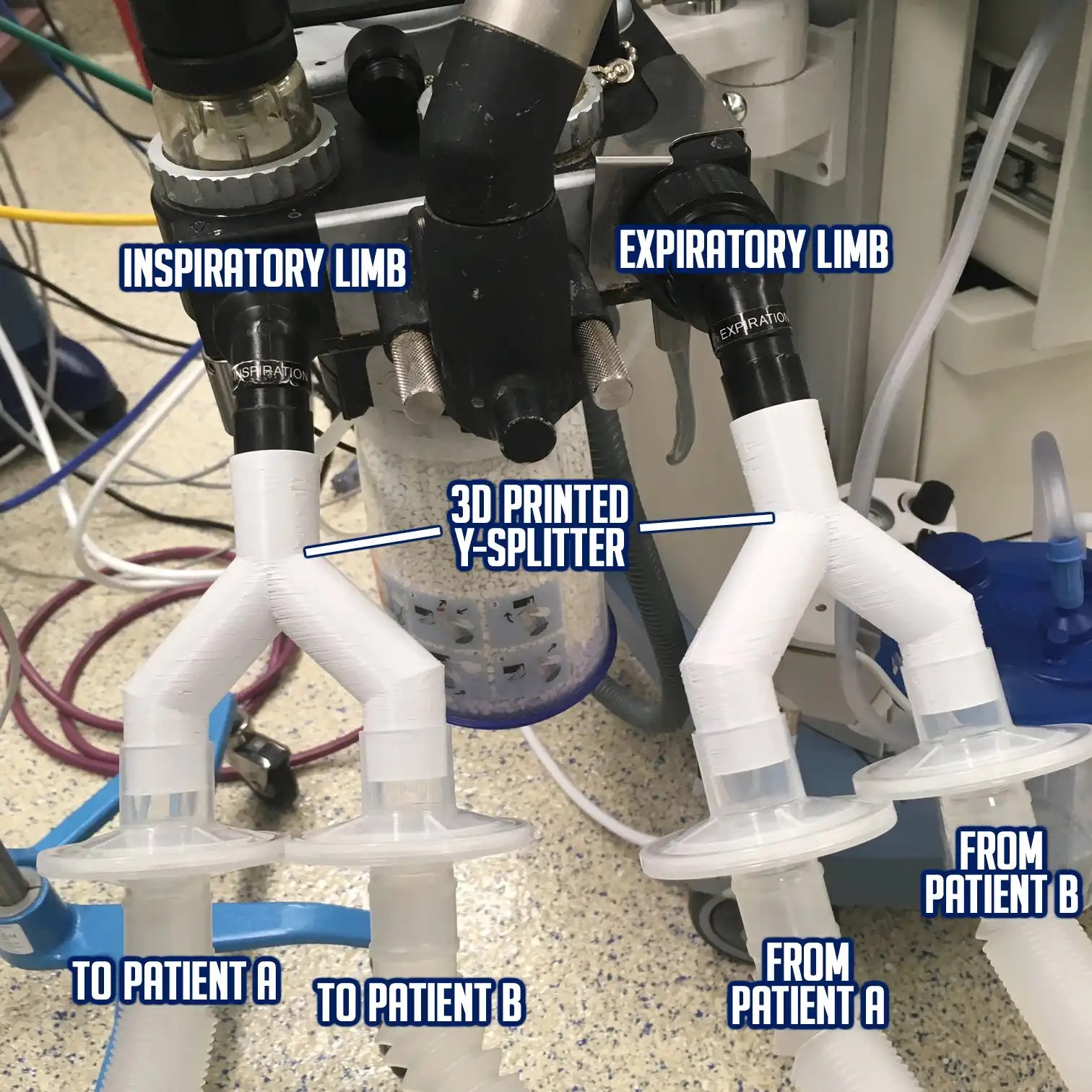 Free 3D Printable Ventilator Circuit Splitter