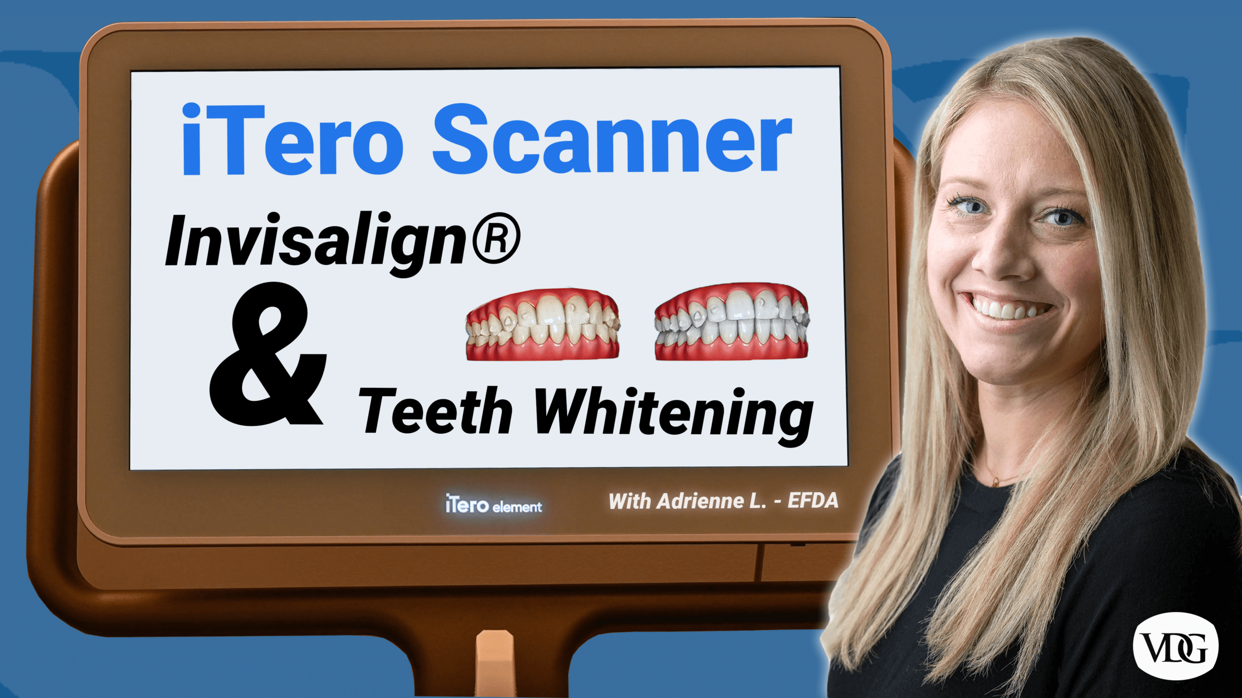 iTero Scan For Invisalign How Your Dentist Scans Your Mouth