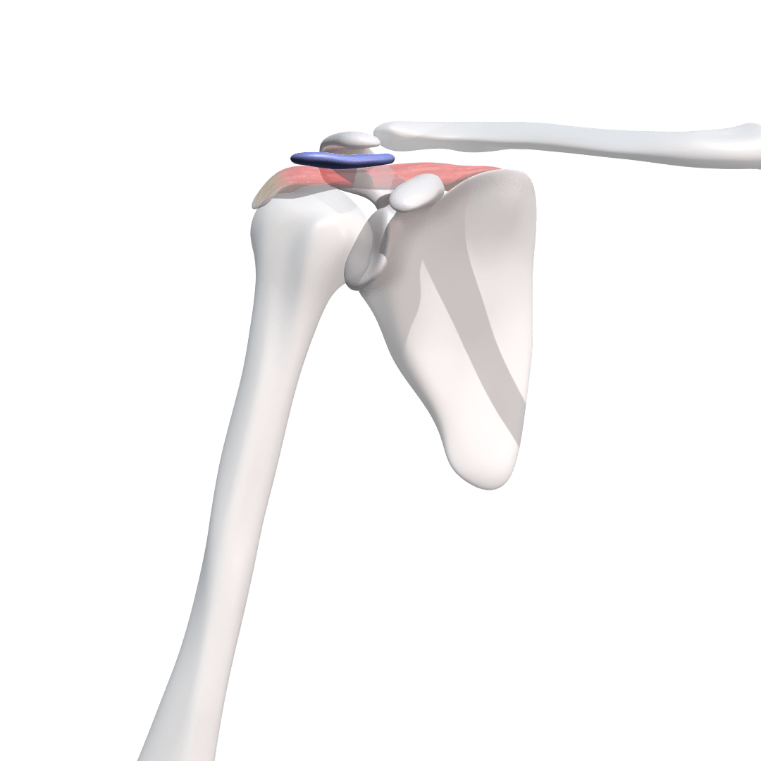 Schleimbeutelentzündung Schulter vom Arzt im Video erklärt Verletzikon