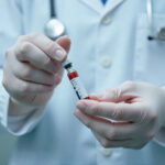 Complete Blood Count (CBC) Analyzer