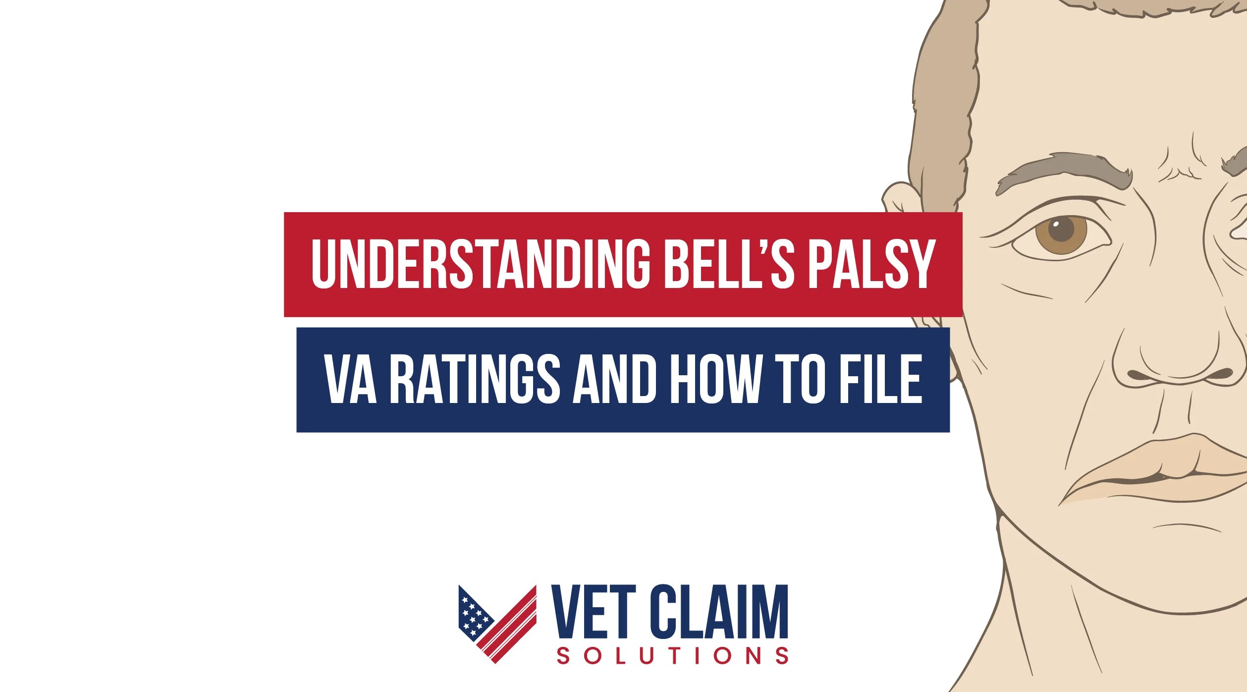 VA Benefits for Veterans with Bell’s Palsy VET CLAIM SOLUTIONS