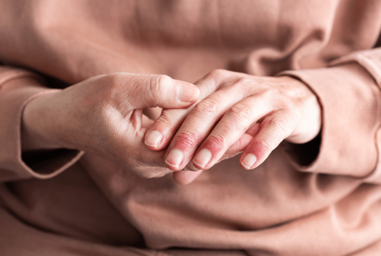 VA Disability Rating for Eczema Veterans Guide