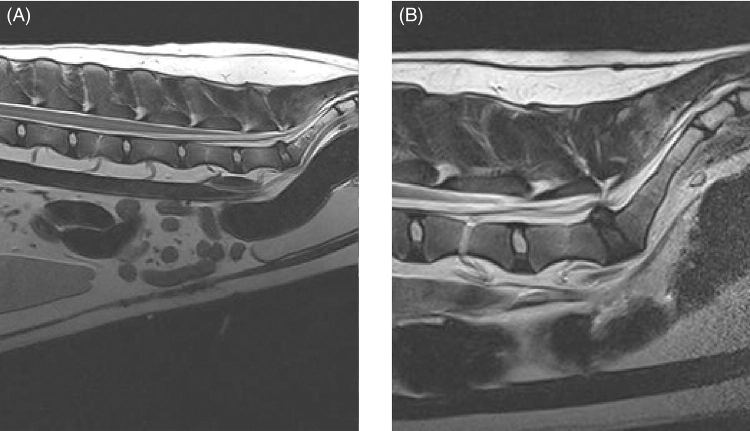 Lumbosacral Disc Disease Veterian Key