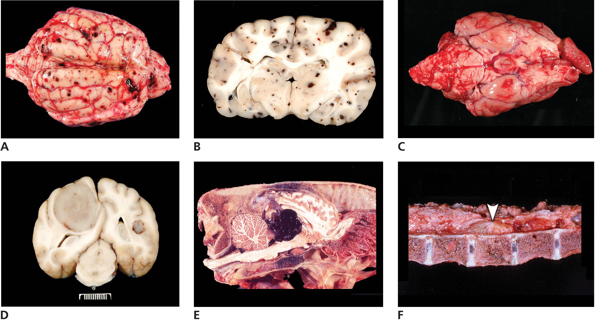 Tumors of the Nervous System Veterian Key