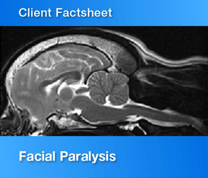 Facial Paralysis factsheet Vet Oracle