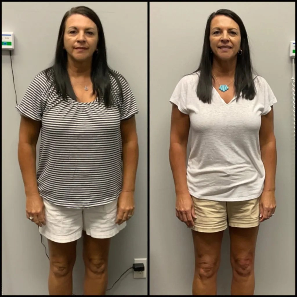 Modern Weight Loss Clinic in Elizabethtown, KY Vibrant Vitalité