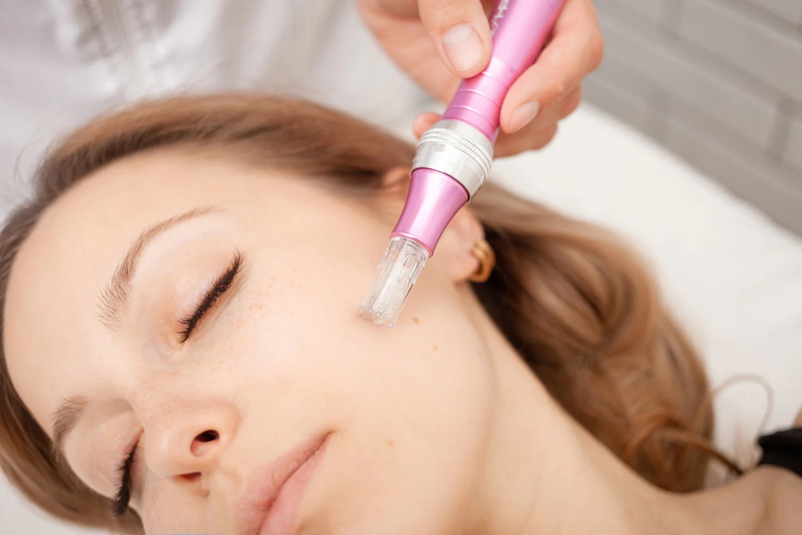Microneedling Hype or Holy Grail? Discover the Truth