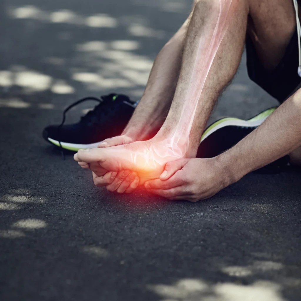 Foot Pain from Running Common Causes & Solutions