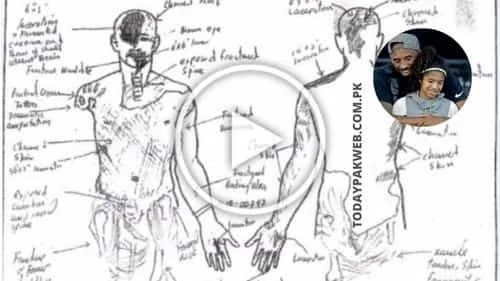 Gigi And Kobe Autopsy Report Kobe Bryant Autopsy Photos