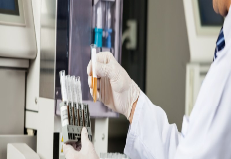 Can Stress Cause Blood in Urine? Health Insights