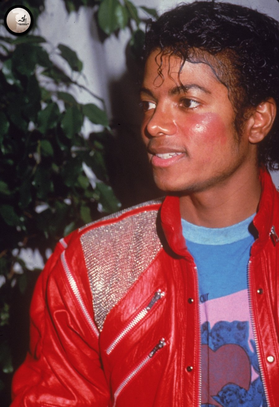 Lupus, Vitiligo, Plastic Surgery and the concept of ‘selfhatred’. Did Michael Jackson want to