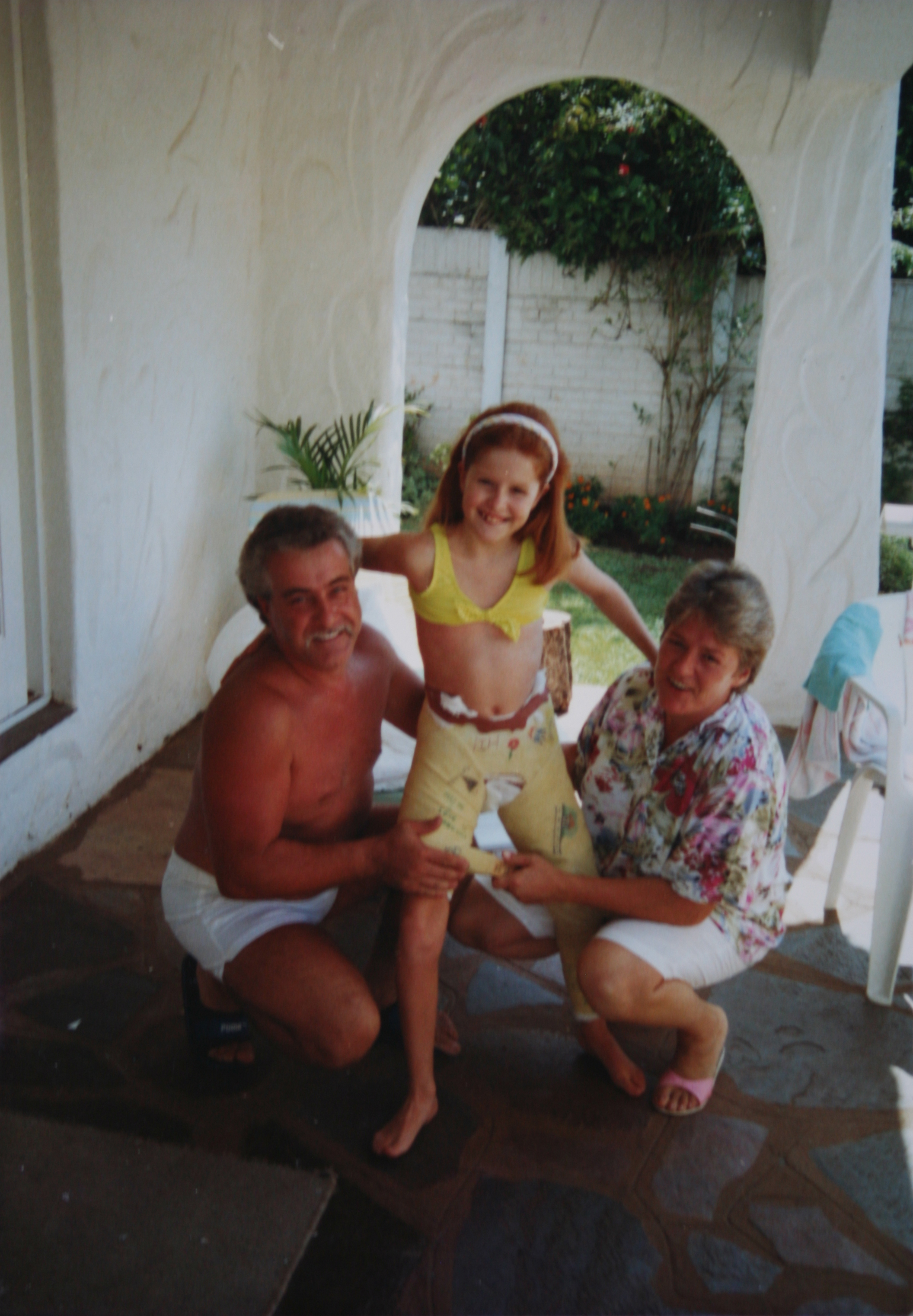 Perthes Disease, Personal Experience and into adulthood Violetsteel