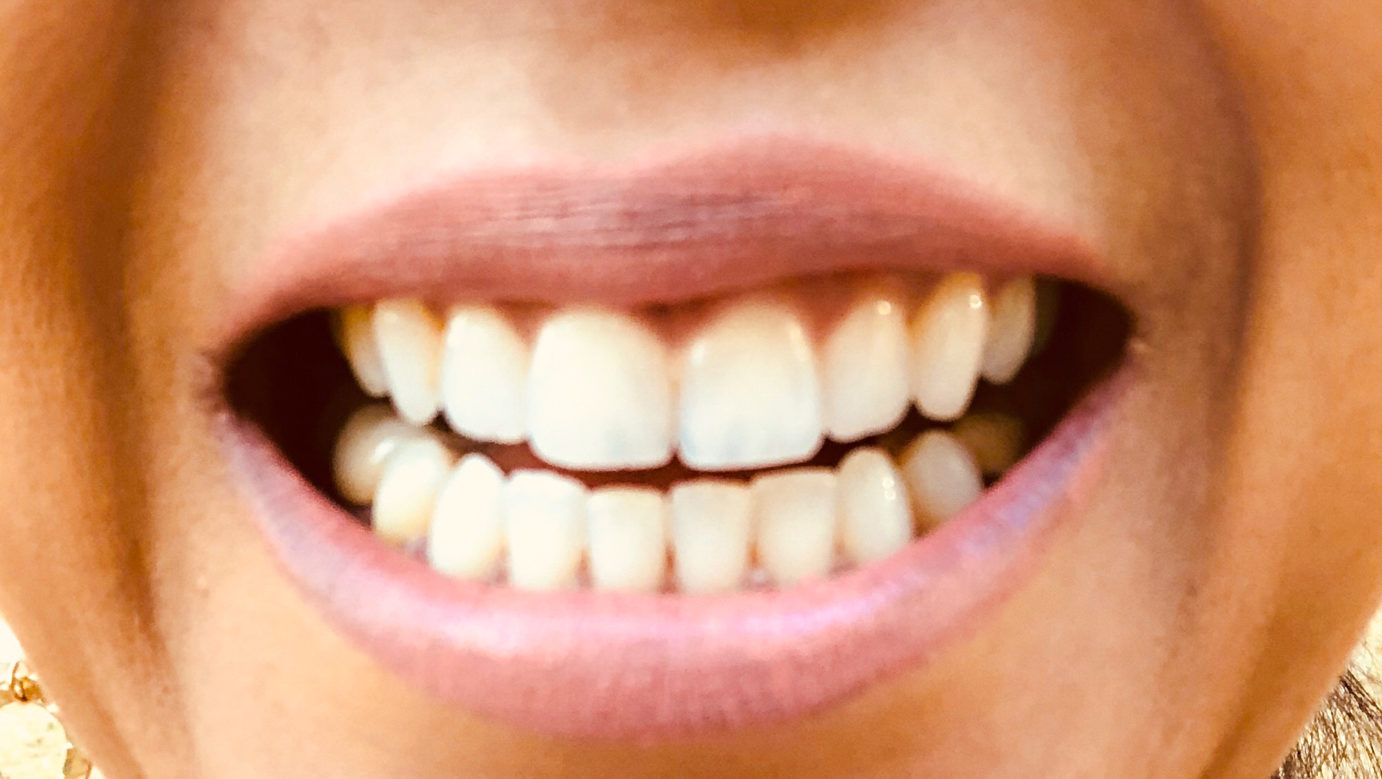 White with Style ‘Beautiful White Teeth for Actors