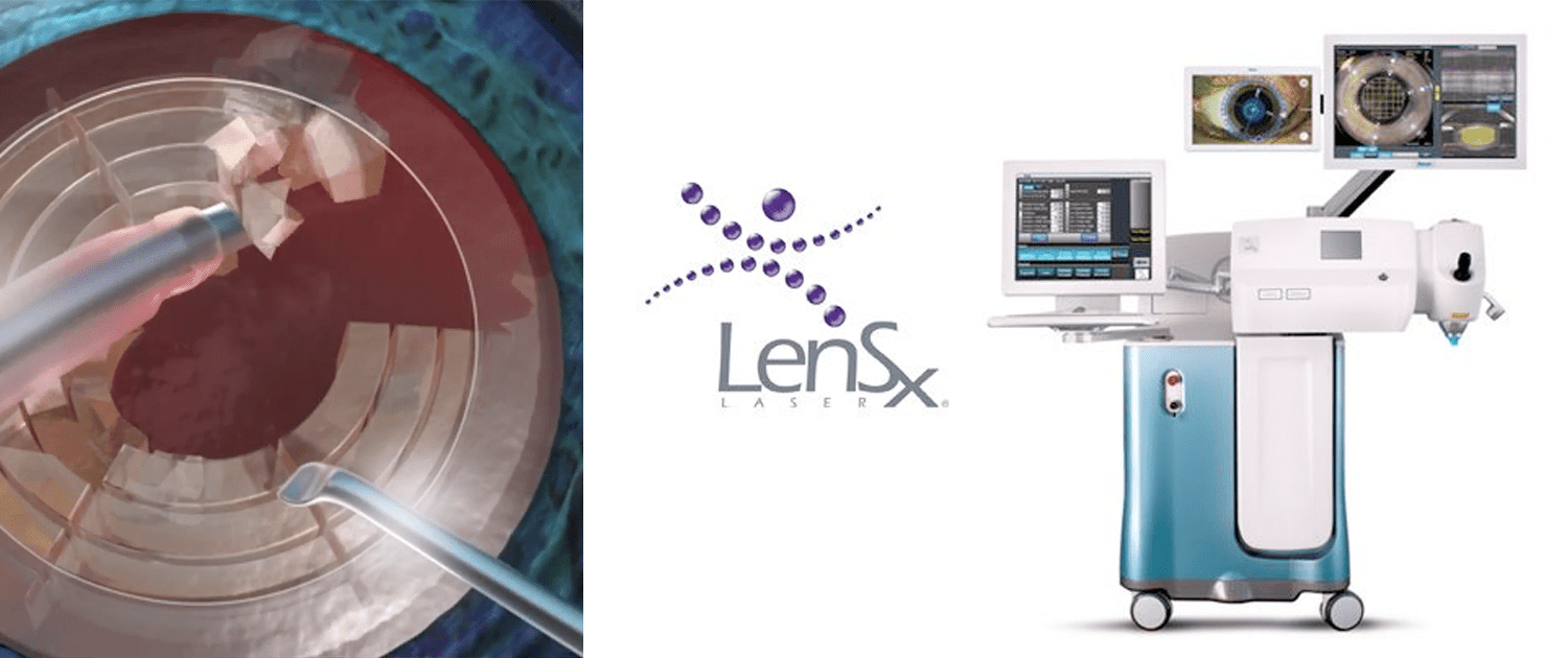 Cataracts VIP Laser Eye Center