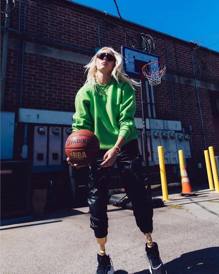Viral Strange - Lauren Wasser: A Remarkable Model's Triumph