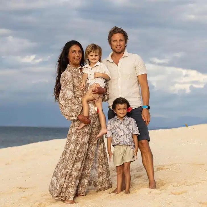 Viral Strange Turia Pitt Got Married Despite Her Disfigurement from