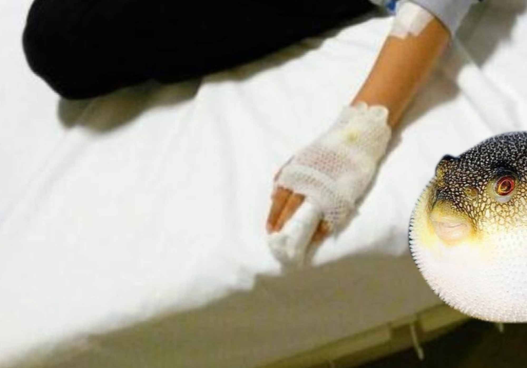 Fish Bites Off 8yos Finger As She Swims In Sea With Dad