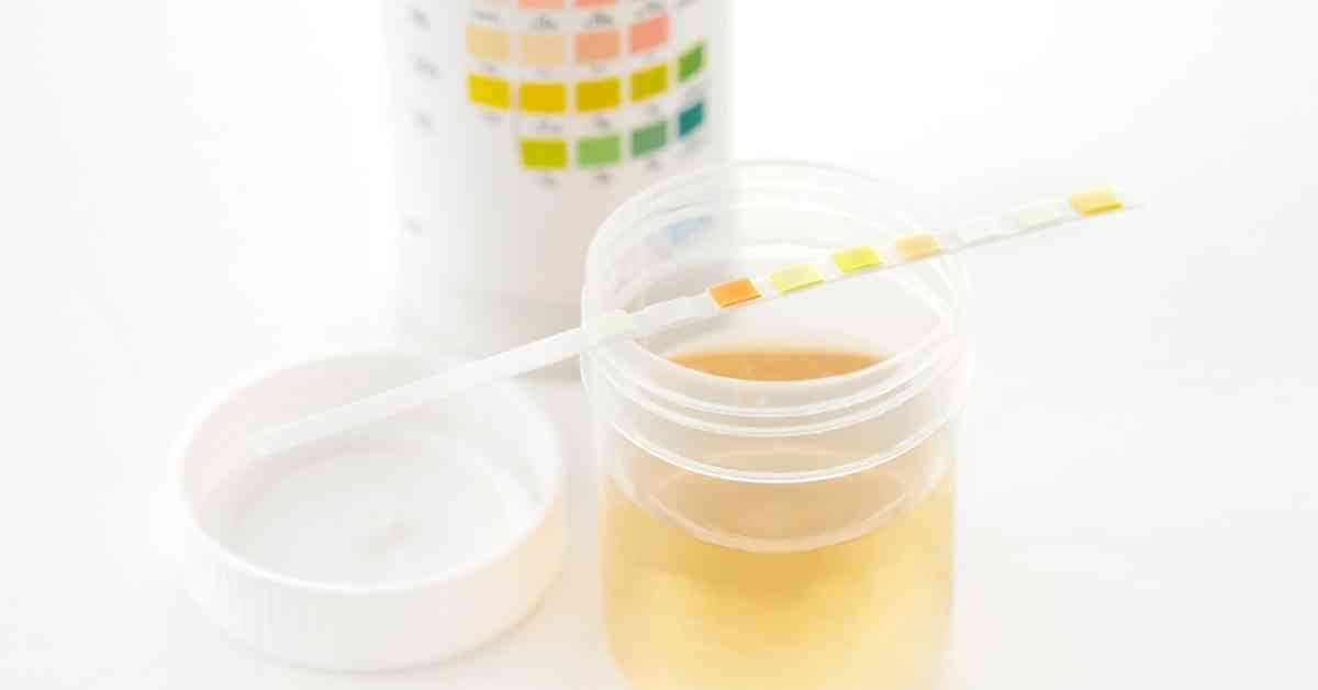 Urinary Tract Infection (UTI) And Online Doctors