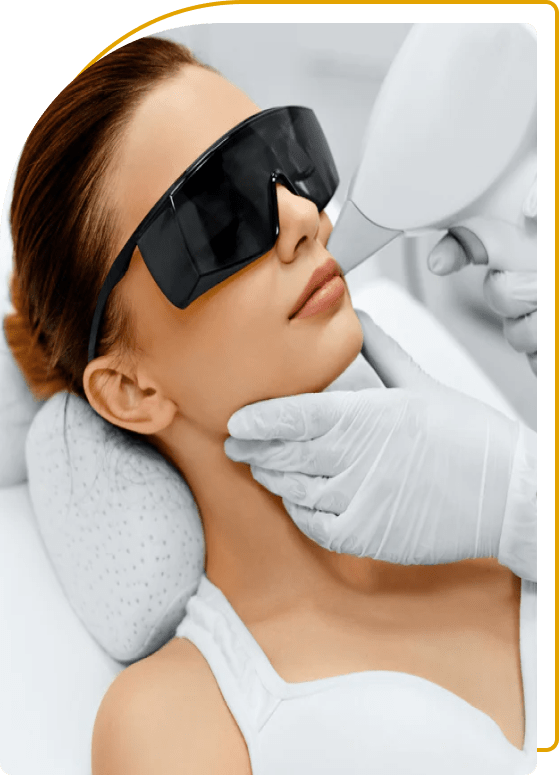 laser hair removal