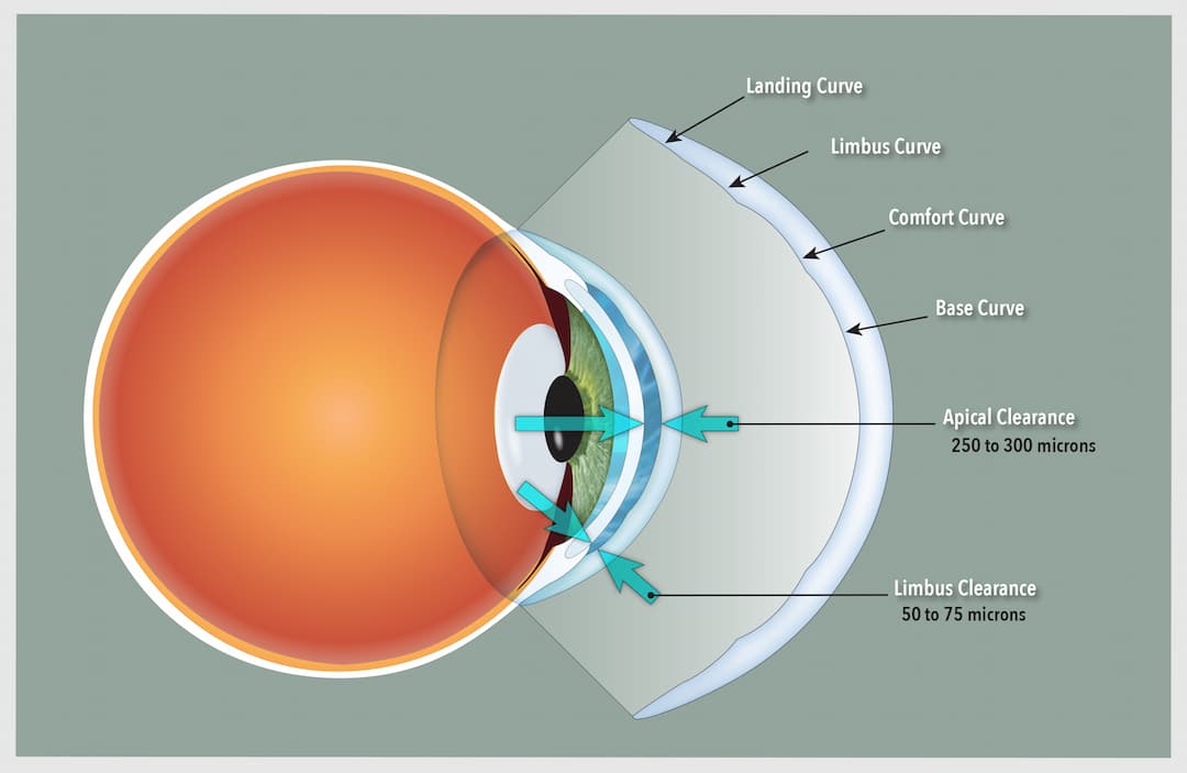 Products & Services Visionary Lens