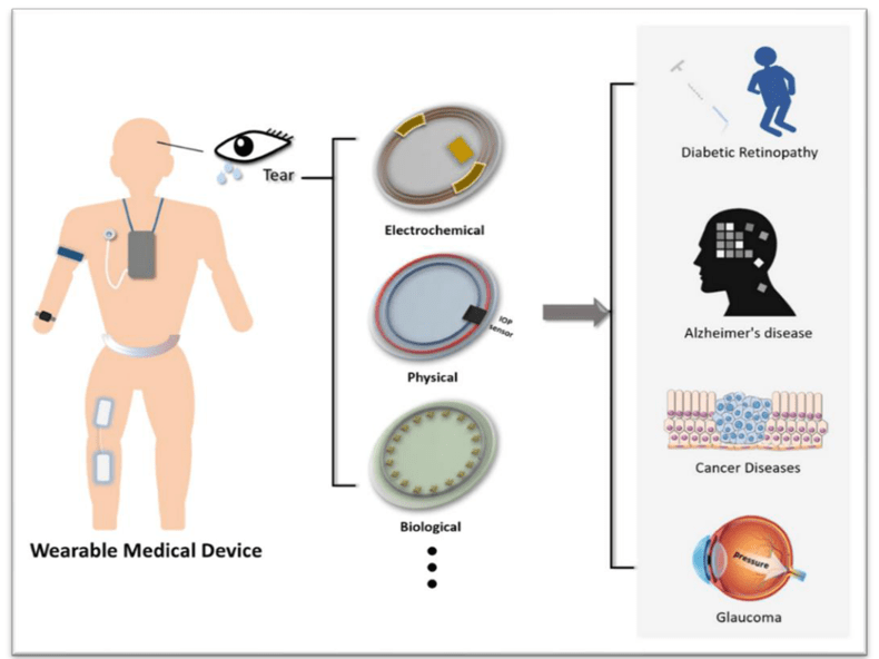 Smart Contact Lens A Future Technology Vision Science Academy