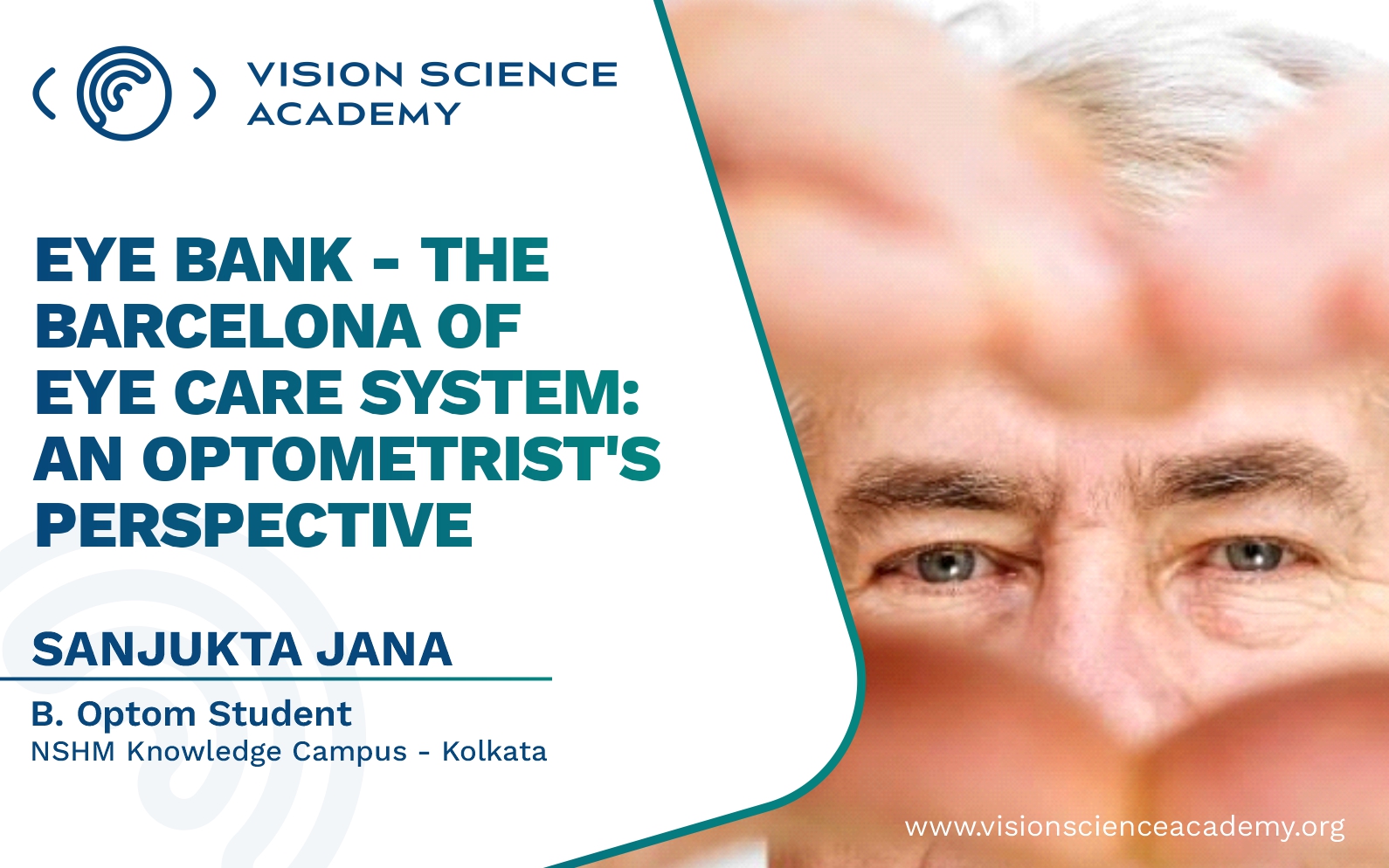 Eye Bank The Barcelona of Eye Care System An Optometrist's
