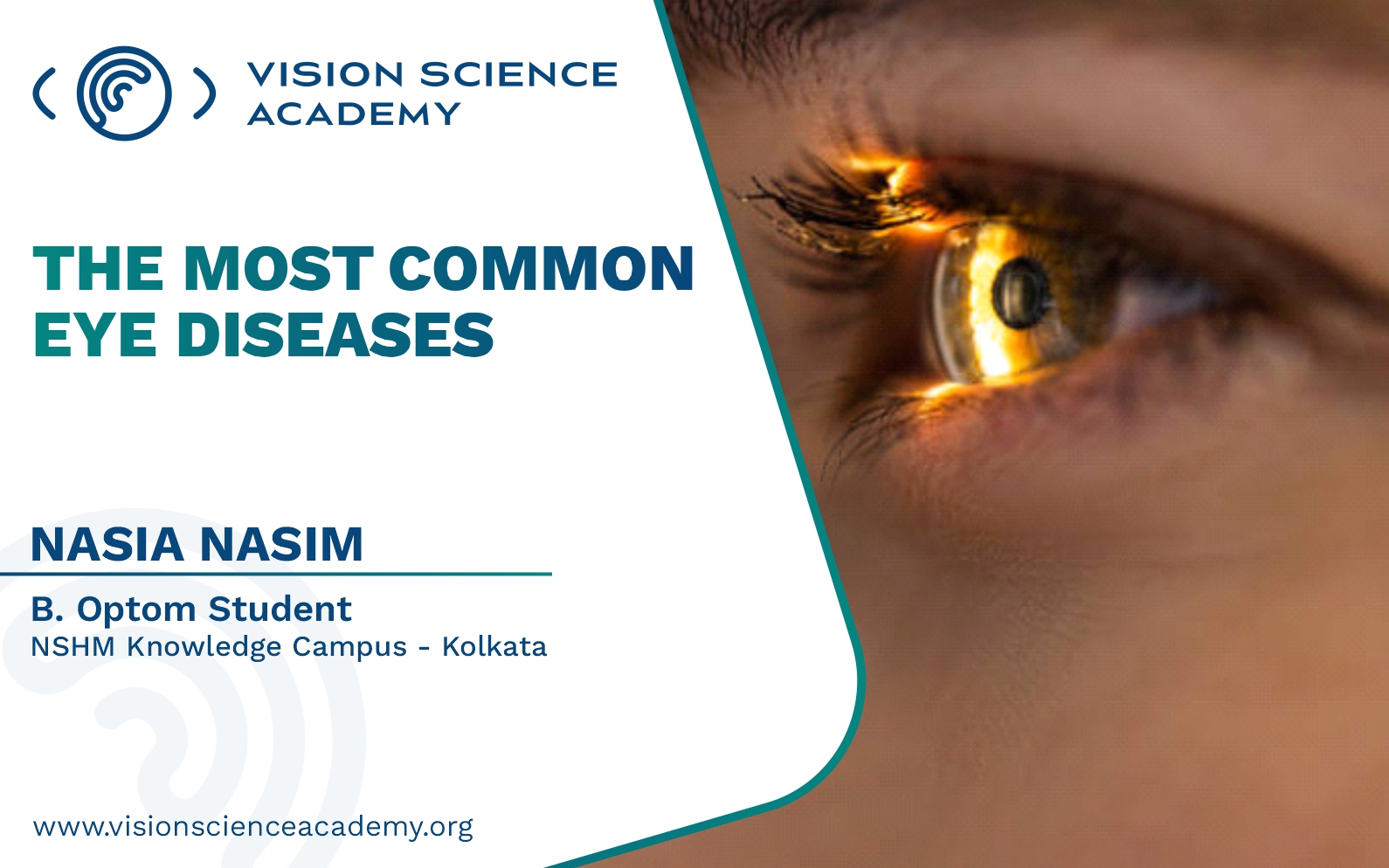 The Most Common Eye Diseases Vision Science Academy