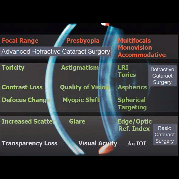 cataractsurgeryoptions Vision Surgery