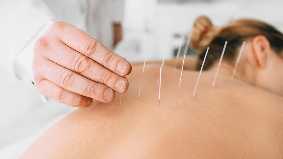 Acupuncture effective for elderly after falls/stroke/ legs no strength