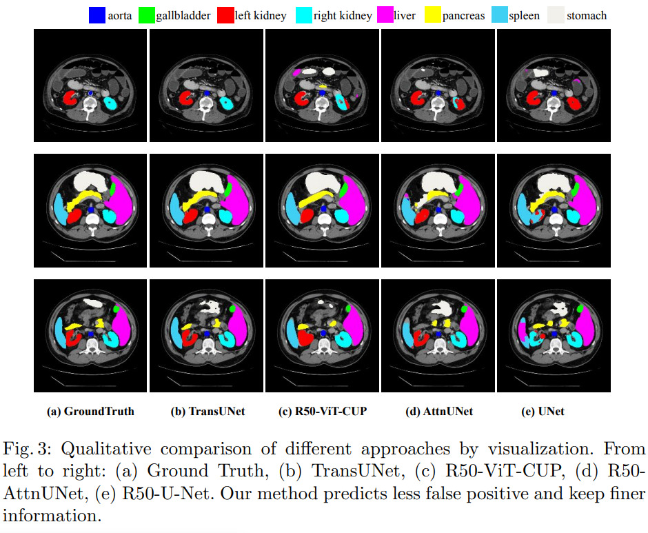 Transformers Make Strong Encoders for Medical Image Segmentation