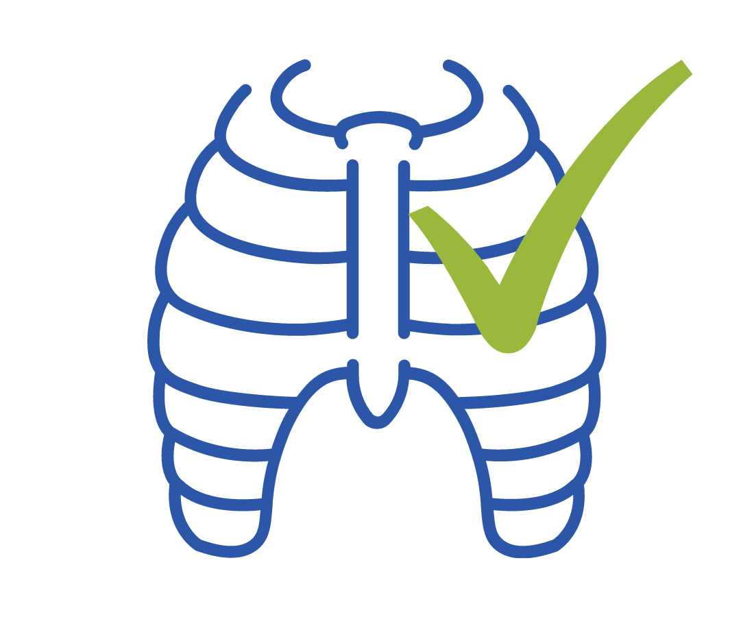 Costochondritis Symptoms, Causes, Treatment Physiotherapy Brisbane