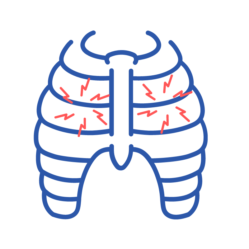 Costochondritis Symptoms, Causes, Treatment Physiotherapy Brisbane
