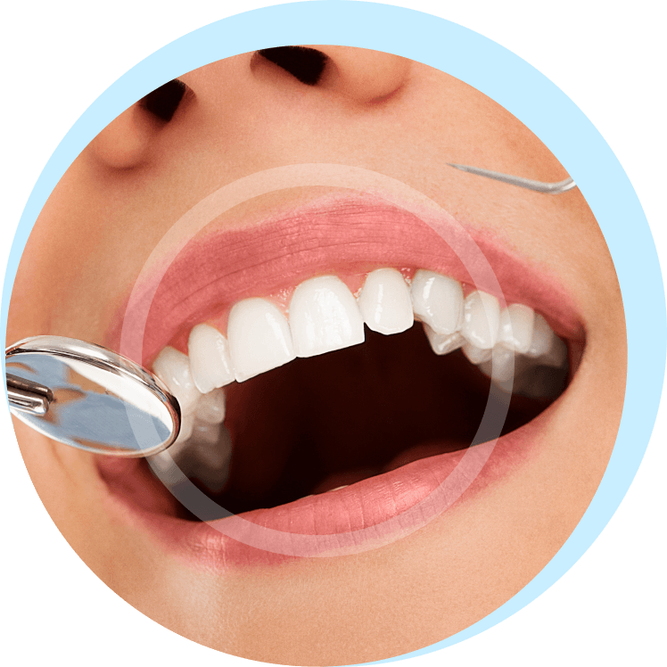 Dental Implant Natural Teeth and Nice Smile! Vitapera