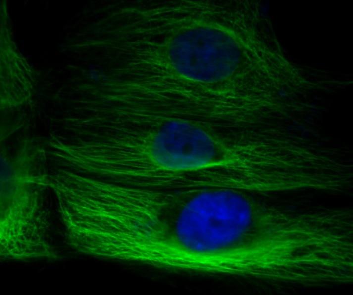 Andy Fluor™ 488 Goat AntiRabbit IgG (H+L) Antibody