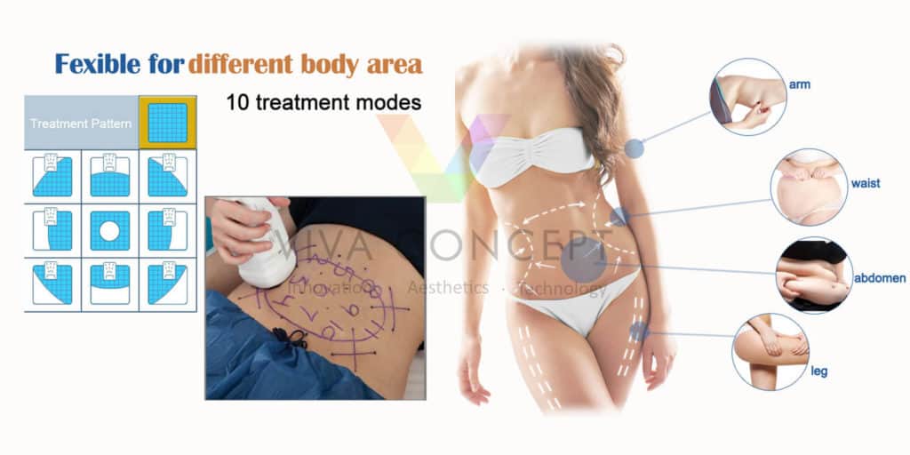 Liposonix machine 2020 Noninvasive weight LossVIVALaser